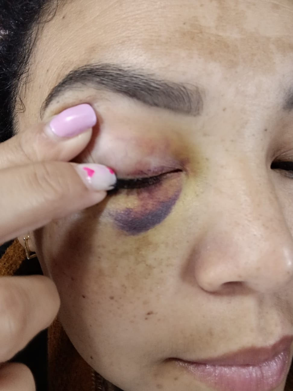 Policías son denunciados por supuesta agresión física injustificada